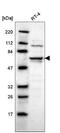 UPF3B Regulator Of Nonsense Mediated MRNA Decay antibody, NBP2-55617, Novus Biologicals, Western Blot image 