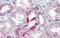 Solute Carrier Family 25 Member 28 antibody, ARP44054_P050, Aviva Systems Biology, Immunohistochemistry frozen image 