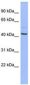 Nuclear Autoantigenic Sperm Protein antibody, TA344626, Origene, Western Blot image 