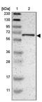 EMAP Like 2 antibody, NBP1-84861, Novus Biologicals, Western Blot image 