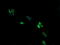 Armadillo Repeat Containing 1 antibody, M14427, Boster Biological Technology, Immunofluorescence image 
