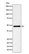 Pancreatic Lipase antibody, M04935-1, Boster Biological Technology, Western Blot image 