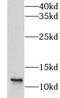 LSM8 Homolog, U6 Small Nuclear RNA Associated antibody, FNab04878, FineTest, Western Blot image 
