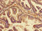 TNF Receptor Superfamily Member 11b antibody, orb400588, Biorbyt, Immunohistochemistry paraffin image 