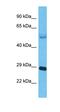 Aph-1 Homolog B, Gamma-Secretase Subunit antibody, orb325898, Biorbyt, Western Blot image 