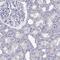 T-Box, Brain 1 antibody, HPA078644, Atlas Antibodies, Immunohistochemistry paraffin image 