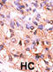 Protein Phosphatase, Mg2+/Mn2+ Dependent 1F antibody, abx033963, Abbexa, Immunohistochemistry paraffin image 