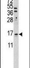 U6 snRNA-associated Sm-like protein LSm1 antibody, PA5-12490, Invitrogen Antibodies, Western Blot image 
