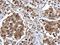 Epidermal Growth Factor Receptor Pathway Substrate 8 antibody, GTX100254, GeneTex, Immunohistochemistry paraffin image 