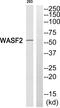 WASP Family Member 2 antibody, PA5-39534, Invitrogen Antibodies, Western Blot image 