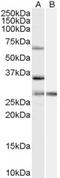 Pre-MRNA Processing Factor 31 antibody, LS-C55323, Lifespan Biosciences, Western Blot image 