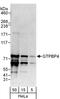 GTP Binding Protein 4 antibody, A303-132A, Bethyl Labs, Western Blot image 