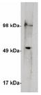 Serine palmitoyltransferase 1 antibody, AP05280PU-N, Origene, Western Blot image 