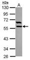Rho GTPase Activating Protein 15 antibody, PA5-31530, Invitrogen Antibodies, Western Blot image 