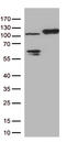 Endoplasmic Reticulum Aminopeptidase 1 antibody, TA812893, Origene, Western Blot image 