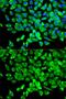 Eukaryotic initiation factor 4A-I antibody, GTX54032, GeneTex, Immunocytochemistry image 