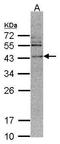 Calcium/Calmodulin Dependent Protein Kinase ID antibody, TA309026, Origene, Western Blot image 
