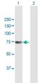 FA Complementation Group M antibody, H00057697-B01P, Novus Biologicals, Western Blot image 
