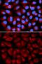 FA Complementation Group C antibody, GTX53977, GeneTex, Immunocytochemistry image 