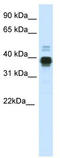 Homeobox A11 antibody, TA342267, Origene, Western Blot image 