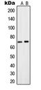 Solute Carrier Family 28 Member 2 antibody, LS-B13618, Lifespan Biosciences, Western Blot image 