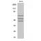 ShcA antibody, LS-C381180, Lifespan Biosciences, Western Blot image 