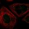Ring Finger Protein 6 antibody, NBP1-84107, Novus Biologicals, Immunofluorescence image 