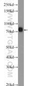 Coagulation Factor II, Thrombin antibody, 24295-1-AP, Proteintech Group, Western Blot image 