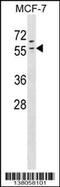 Zinc Finger Protein 383 antibody, 59-534, ProSci, Western Blot image 