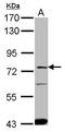 Solute Carrier Family 27 Member 4 antibody, PA5-27283, Invitrogen Antibodies, Western Blot image 