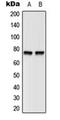 Bruton Tyrosine Kinase antibody, orb216040, Biorbyt, Western Blot image 