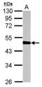 Homocysteine Inducible ER Protein With Ubiquitin Like Domain 1 antibody, PA5-29469, Invitrogen Antibodies, Western Blot image 