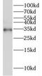 Secreted frizzled-related protein 3 antibody, FNab03227, FineTest, Western Blot image 