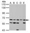 Acyl-CoA Synthetase Long Chain Family Member 6 antibody, NBP2-15253, Novus Biologicals, Western Blot image 