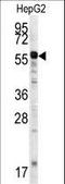 Matrix metalloproteinase-20 antibody, LS-C100449, Lifespan Biosciences, Western Blot image 