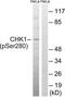 Serine/threonine-protein kinase Chk1 antibody, TA311862, Origene, Western Blot image 