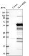 Solute Carrier Family 7 Member 6 Opposite Strand antibody, PA5-59614, Invitrogen Antibodies, Western Blot image 