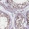 Chromosome 11 Open Reading Frame 49 antibody, HPA040280, Atlas Antibodies, Immunohistochemistry frozen image 