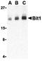 Peptidyl-TRNA Hydrolase 2 antibody, orb74654, Biorbyt, Western Blot image 