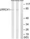 Leucine Rich Repeat Containing 41 antibody, TA315061, Origene, Western Blot image 