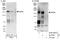 Probable histone-lysine N-methyltransferase NSD2 antibody, A303-093A, Bethyl Labs, Immunoprecipitation image 
