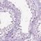 HHIP Like 2 antibody, NBP2-49302, Novus Biologicals, Immunohistochemistry frozen image 