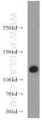 Heat shock 70 kDa protein 4 antibody, 21206-1-AP, Proteintech Group, Western Blot image 