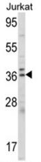 Aminolevulinate Dehydratase antibody, AP17099PU-N, Origene, Western Blot image 
