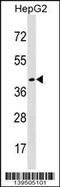 Desert hedgehog protein antibody, 60-360, ProSci, Western Blot image 