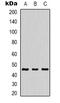 Mitogen-Activated Protein Kinase Kinase 1 antibody, orb338966, Biorbyt, Western Blot image 
