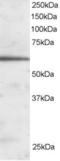 Forkhead Box A2 antibody, EB06000, Everest Biotech, Western Blot image 