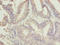 Chromosome 10 Open Reading Frame 82 antibody, LS-C399782, Lifespan Biosciences, Immunohistochemistry paraffin image 