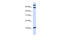 Galanin And GMAP Prepropeptide antibody, 27-229, ProSci, Western Blot image 