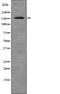c-met antibody, PA5-64802, Invitrogen Antibodies, Western Blot image 